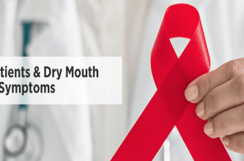 AIDS And Dry Mouth