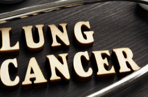 Lung Cancer And Dry Mouth