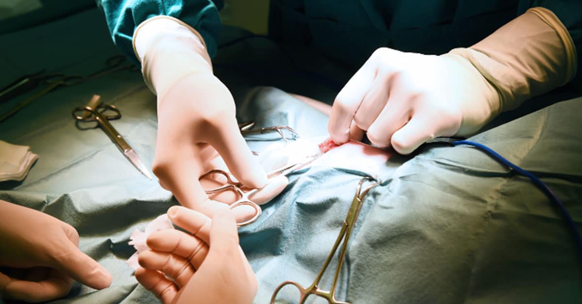 Dry Mouth After Bariatric Surgery