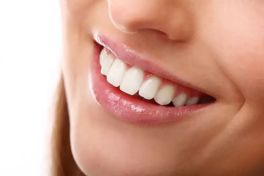 A woman learned How To Strengthen Your Teeth and now she has a beautiful smile.