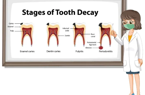 Periodontists and Periodontal Disease: What You Need to Know