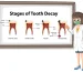 Periodontists and Periodontal Disease: What You Need to Know