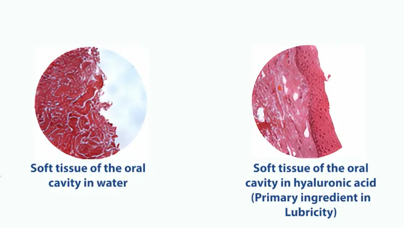 A graphic showing the difference between oral tissue being hydrated by water, and oral tissue being hydrated by hyaluronic acid, the principal ingredient in Lubricity which in the end is more effective at hydrating the oral tissues and promoting overall oral health.